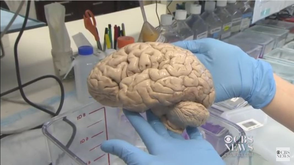 Families Donate Brains To Help Autism Research